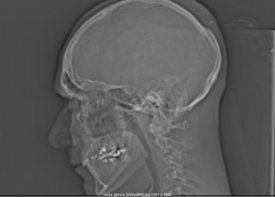 piotr echo (echo), brussel, pisz