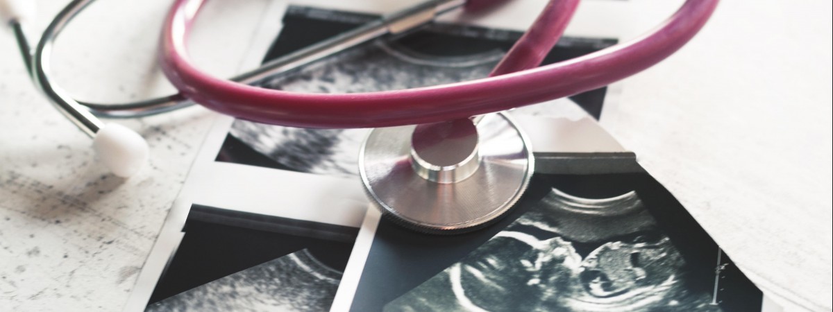 Prawo aborcyjne w Niderlandach – jakie opcje posiadają obywatelki kraju tulipanów? 
