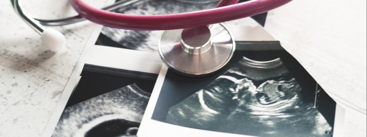 Holandia z jeszcze łatwiejszym dostępem do aborcji. Parlament zatwierdził nowe prawo