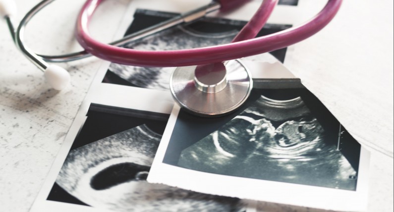 Holandia z jeszcze łatwiejszym dostępem do aborcji. Parlament zatwierdził nowe prawo