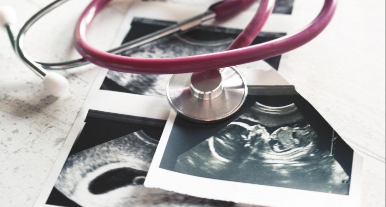 Prawo aborcyjne w Niderlandach – jakie opcje posiadają obywatelki kraju tulipanów? 